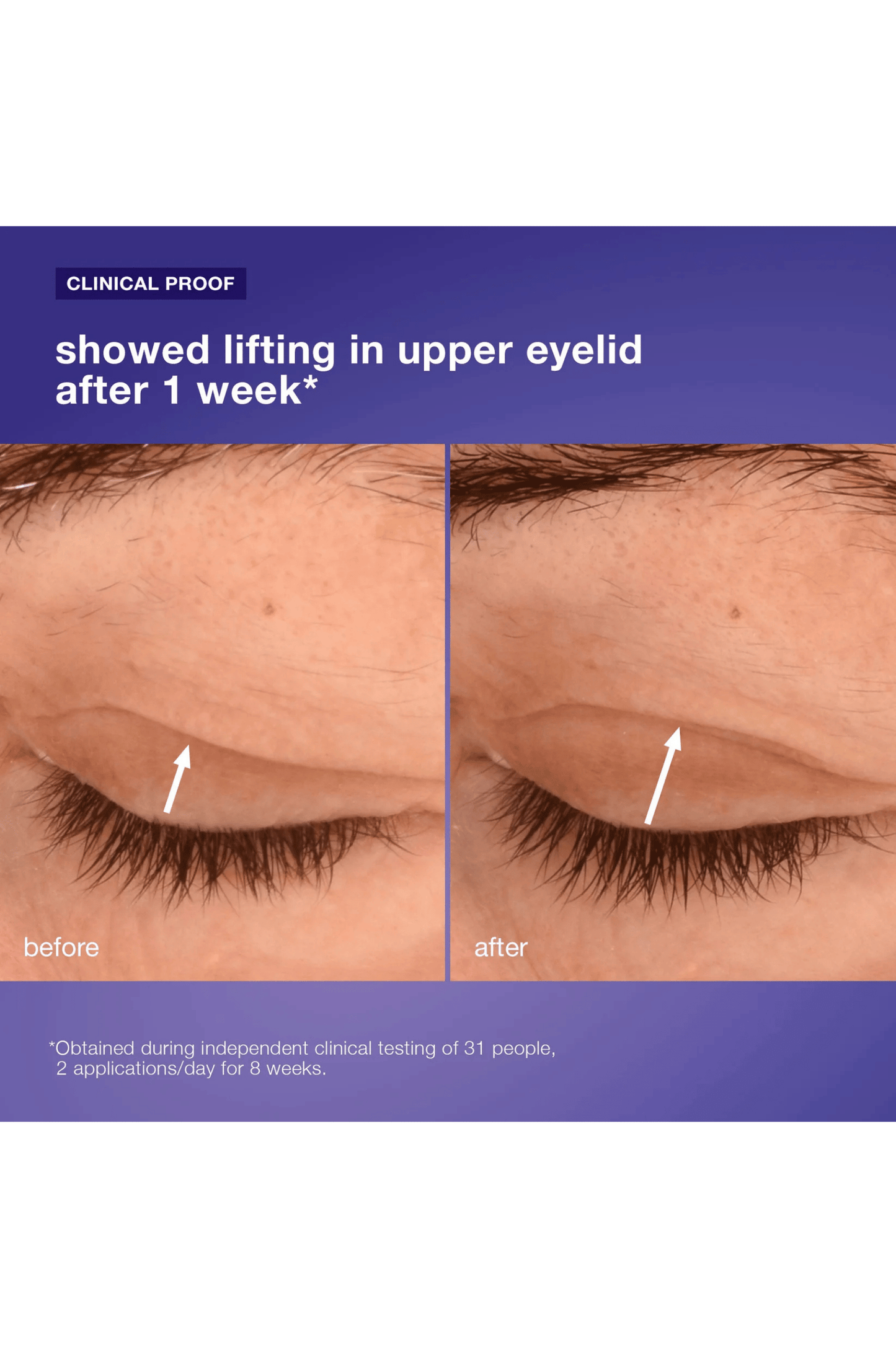Phyto Nature Lifting Eye Cream