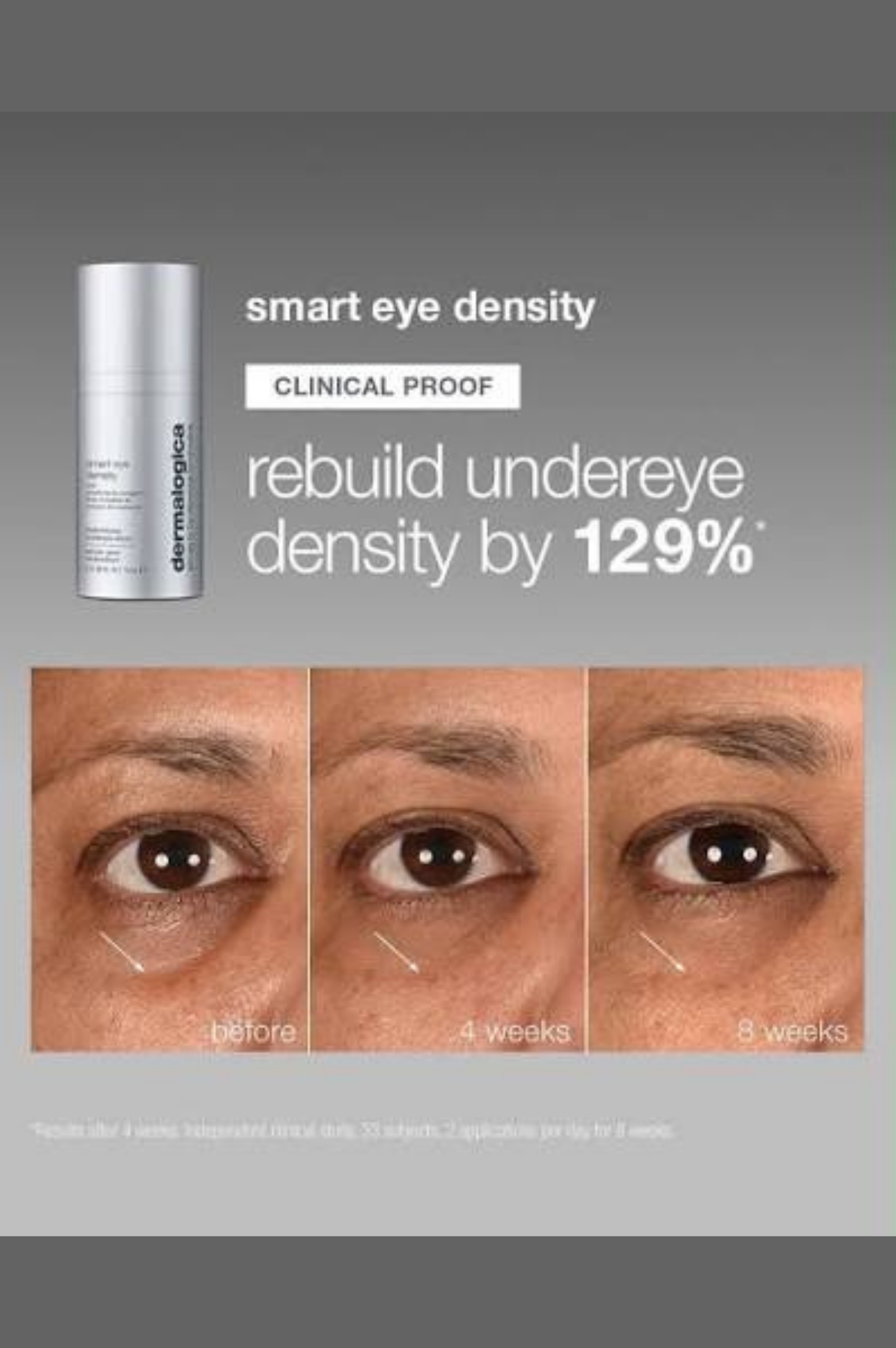 Smart Eye Density