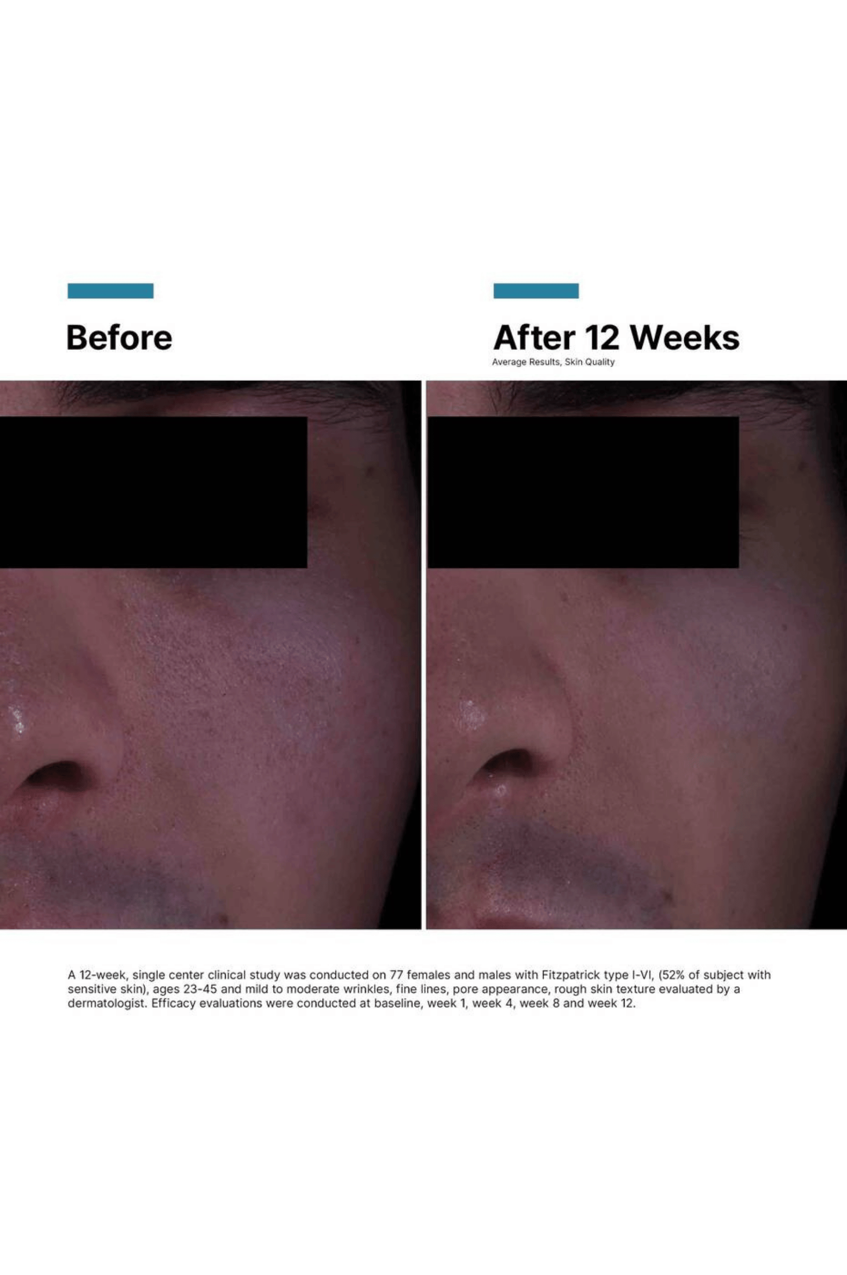 P-Tiox Face Cream