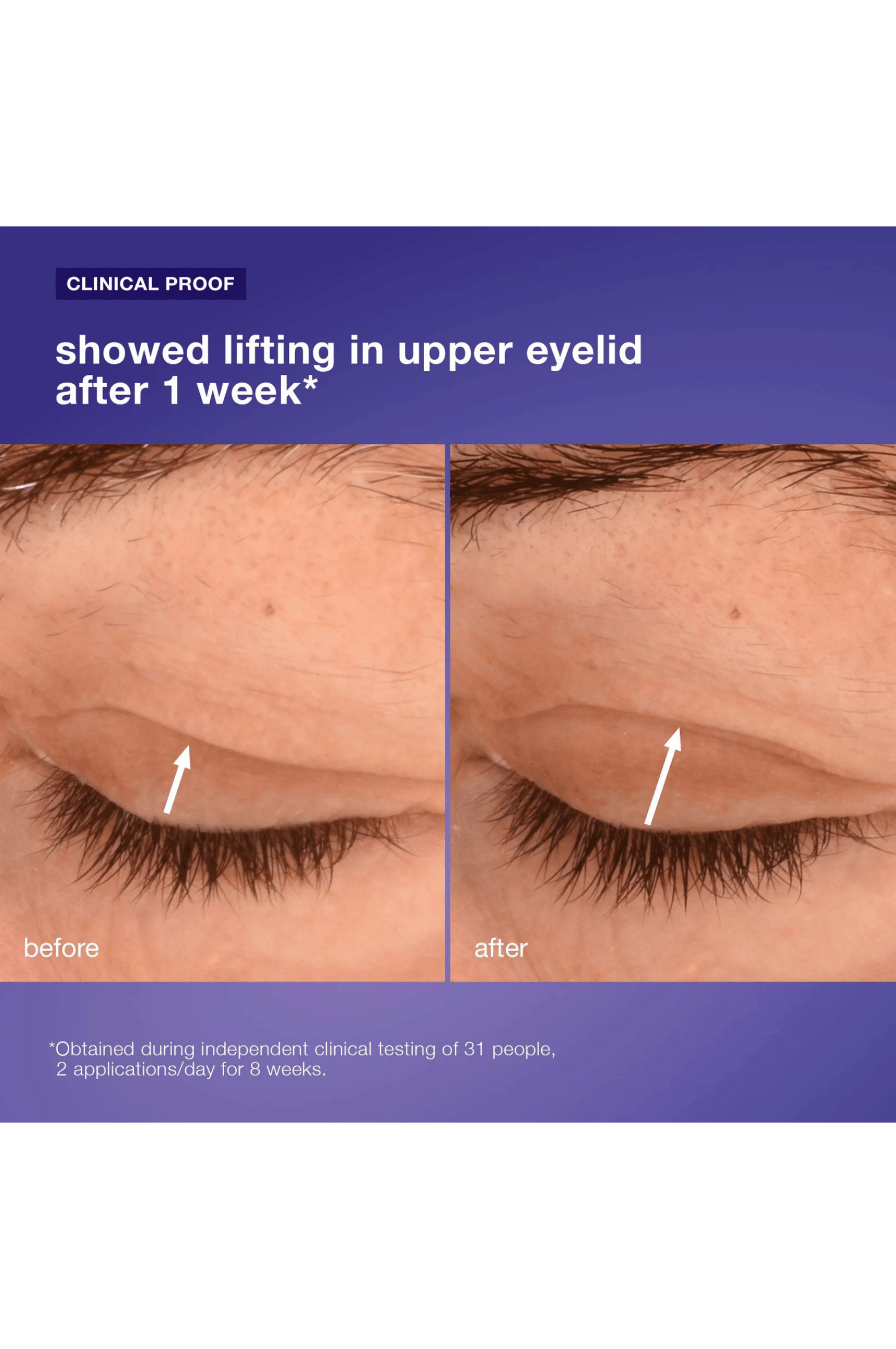 Phyto Nature Lifting Eye Cream