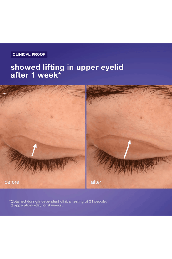 Phyto Nature Lifting Eye Cream
