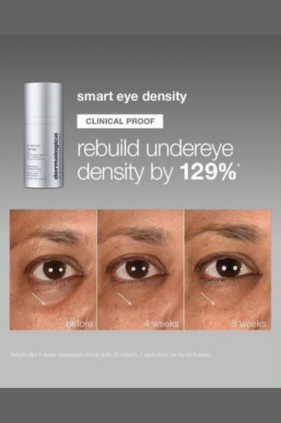 Smart Eye Density